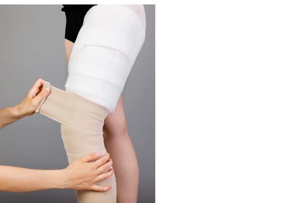 zwachtelen onderbeen door oedeemtherapeut